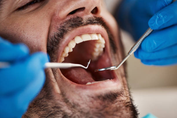 Best Walk-In Emergency Dental Services in Guerneville, CA
